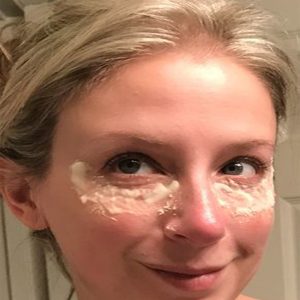 How to Get Rid of Dark circles Under Eyes